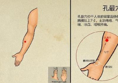 中医针灸有几种针法