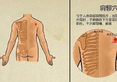 中医针灸一次费用多少