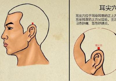中医可以治疗痔疮吗