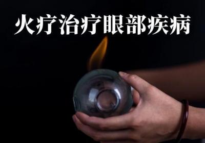 火疗的功效与作用 火疗有什么好处