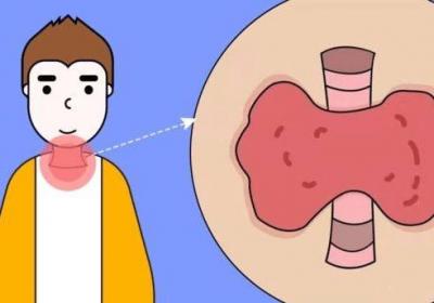 甲状腺癌来临，身体会出现哪几个警告呢？