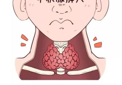 甲状腺炎来临时，身体会有这5个“异常”，别忽视了