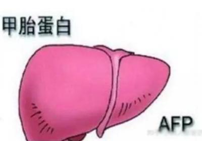 肝癌患者如何预防甲胎蛋白升高