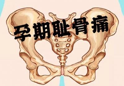 孕妇怎么缓解耻骨疼痛