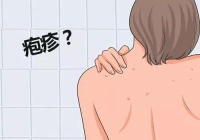 你害怕疱疹吗？要如何抵御呢？