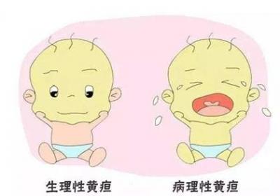 婴幼儿脸黄只是因为黄疸吗