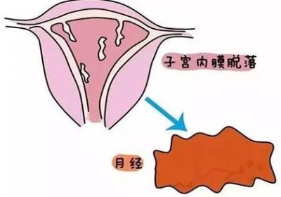 每次月经都提前？那么月经提前正常吗