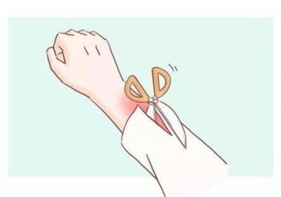 被烫伤后应该怎么处理