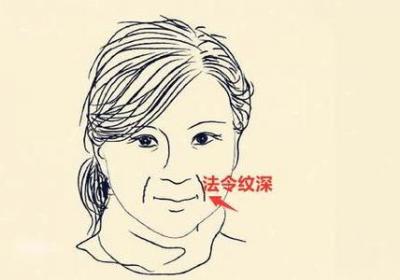 法令纹是怎样形成的