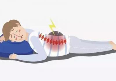 急性腰扭伤之针灸疗法
