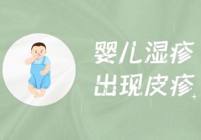婴儿湿疹的症状 婴儿湿疹有什么表现？