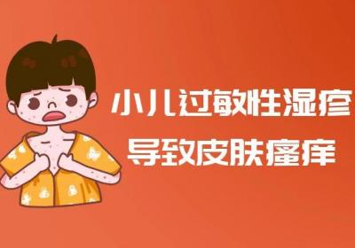 小儿过敏性湿疹的症状有哪些？多为这几个表现