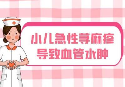 小儿急性荨麻疹的症状有哪些？常见表现有这几个