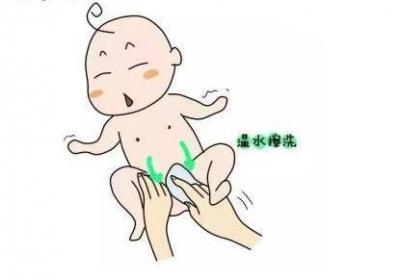 新生儿脐带护理细节