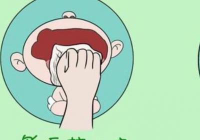 婴幼儿如何护理口腔