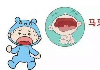 小宝宝长马牙怎么办