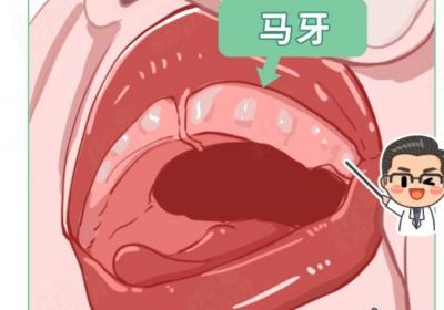 马牙是什么
