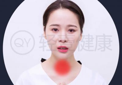 喉炎引起的原因有哪些？常见因素有这几个