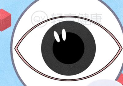 视网膜脱离的症状有哪些？多为这几个表现