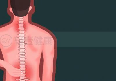 腰椎病的锻炼方法有哪些？