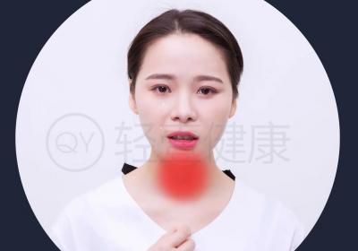 慢性咽喉炎的症状有哪些？是什么原因导致？