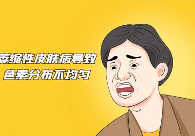 萎缩性皮肤病的症状、病因、治疗一览