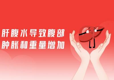肝硬化腹水的症状 肝硬化腹水有什么表现？