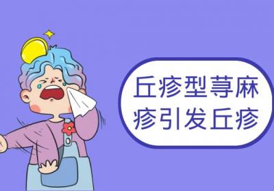 丘疹型荨麻疹的症状 丘疹型荨麻疹有什么表现？