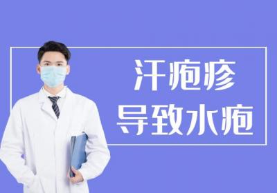 汗疱疹的症状 汗疱疹有什么表现？