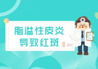 脂溢性皮炎的症状 脂溢性皮炎有什么表现？