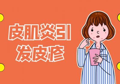 皮肌炎的症状 皮肌炎有什么表现？
