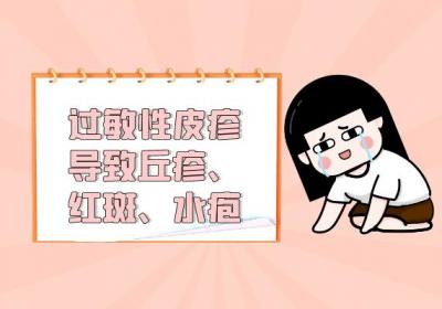 过敏性皮疹的症状 过敏性皮疹有什么表现？
