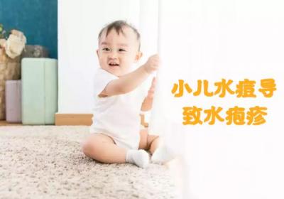 小儿水痘的症状 小儿水痘有什么表现？