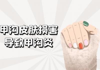甲沟炎引起的原因有哪些？常见因素有这几个