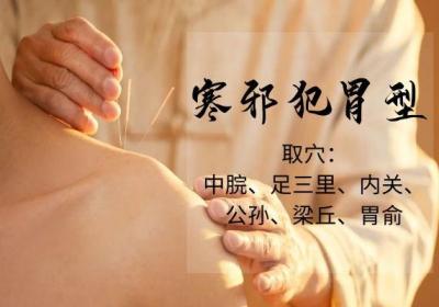 关于胃脘痛针灸治疗你了解多少？