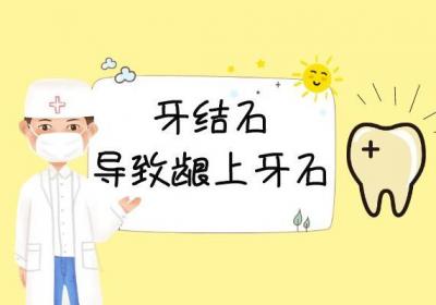 牙结石的症状牙结石有什么表现？