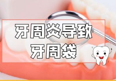 牙周炎的症状牙周炎有什么表现？
