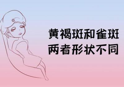 黄褐斑与雀斑的区别有哪些？