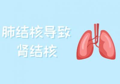 肾结核引起的原因有哪些？这几个因素要尽量远离