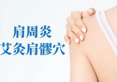 肩周炎艾灸穴位 艾灸这几个穴位可有效改善症状