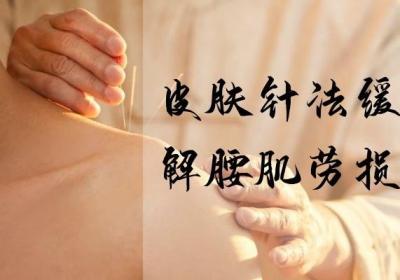 关于腰肌劳损针灸治疗方法你了解多少？