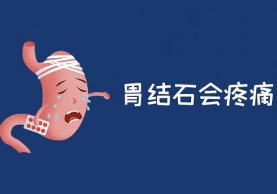 胃结石的症状有哪些？是什么原因引起的？