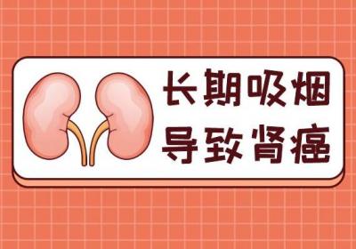 引起肾癌的原因有哪些？这几点不容忽视