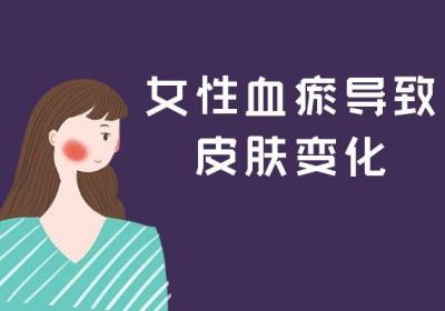 女性血瘀体质的症状和表现有哪些？