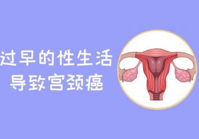 引发宫颈癌的原因有哪些？什么因素导致疾病高发？