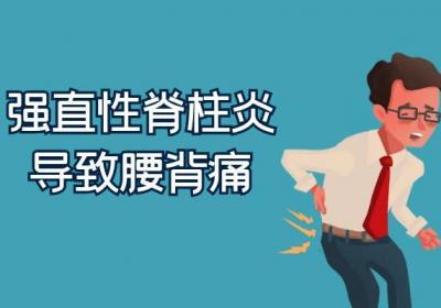 强直性脊柱炎的症状表现有哪些？常见的有这几个