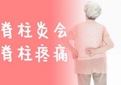 脊柱炎的症状 脊柱炎有什么表现