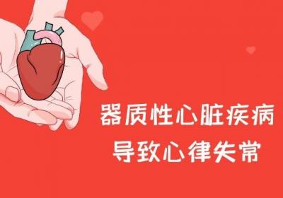 引起心律失常的原因有哪些？比较常见的有以下几种