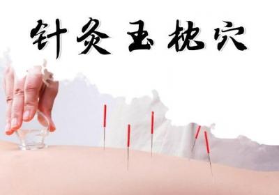视神经炎的针灸治疗方法以及针灸穴位有哪些？