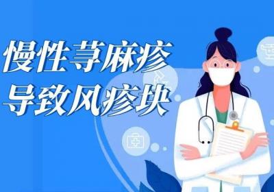 慢性荨麻疹的症状有哪些？多为这几个表现